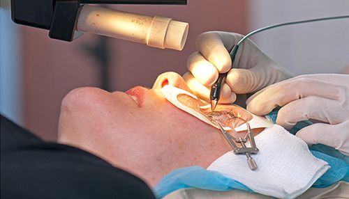 👁️ جراحی چشم؛ نگاهی نو به دنیای بینایی