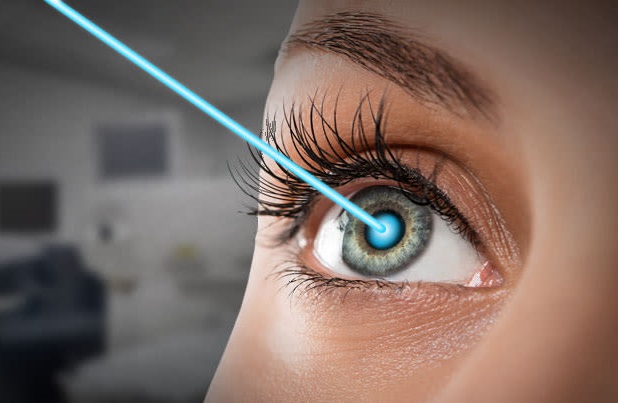 کاندید مناسب لیزیک چشم چه کسانی هستند؟ بررسی کامل توسط متخصص
