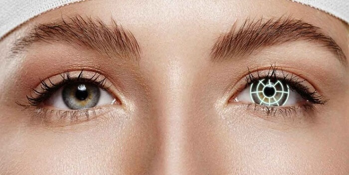 اصلاح عیوب انکساری چشم با جدیدترین تکنیکها در گیلان