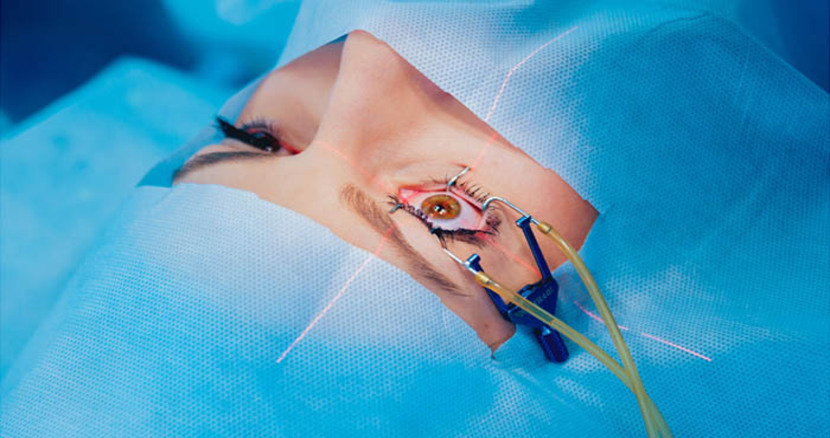 عمل لیزیک و لازک در آستانه اشرفیه | کدام روش مناسب‌تر است؟